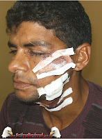 frei martinho terceiravitima 800